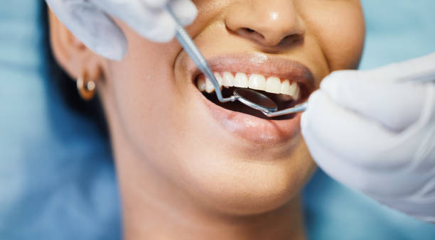 Best Broken or Chipped Tooth Repair in Fort Washington, PA