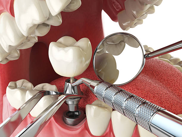 Best Emergency Treatment for Jaw Pain or Injury in Fort Washington, PA